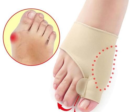 hallux valgus : Traitement conservateur ou chirurgie ?