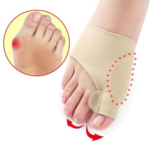 hallux valgus : Traitement conservateur ou chirurgie ?